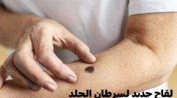 رئيس "موديرنا" يعلن عن لقاح جديد يعالج مرض سرطان الجلد