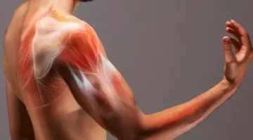ما هي أهم أعراض مرض السرطان ساركوما وأبرز طرق تشخيصه؟