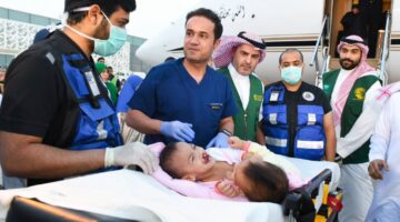 مستشفى الملك عبد الله التخصصي تعلن نجاح عملية فصل التوأم السيامي الفلبيني
