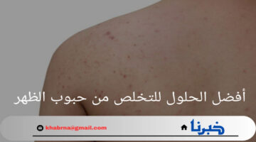 لم تخطر على بالك من قبل.. أفضل الحلول للتخلص من حبوب الظهر واهم الأسباب ظهورها