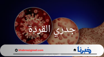 جدري القردة.. هل نحن على أعتاب أزمة صحية عالمية جديدة؟