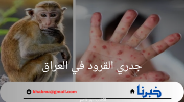 وزارة الصحة العراقية تنفي أنباء انتشار جدري القرود في العراق 2024