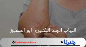 ما هو التهاب الجلد البكتيري ابو الصميق الذي أثار الجدل في السودان وأهم أعراضه؟ الصحة السودانية تجيب