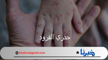 منظمة الصحة العالمية توضح تفاصيل جديدة عن فيروس جدري القرود