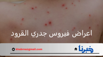 ما هي أهم اعراض فيروس جدري القرود وأبرز طرق انتقاله؟