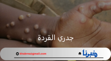 منظمة الصحة العالمية.. تعرب عن قلقها من تفشي فيروس جدري القردة عالمياً