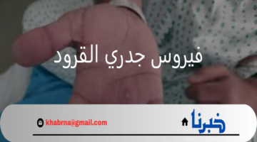 منظمة الصحة العالمية.. فيروس جدري القردة يواصل انتشاره خارج القارة الإفريقية