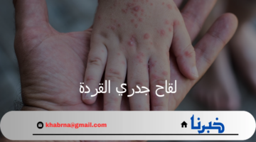 مركز أبحاث روسي يعلن عن إتاحة لقاح جدري القردة للوقاية منه