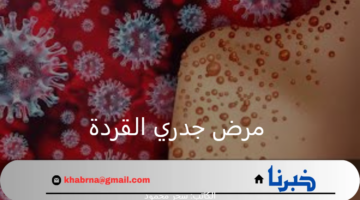 ماذا تعرف عن مرض جدري القردة.. وما هي أعراضه؟ منظمة الصحة العالمية توضح
