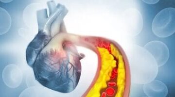 7 نصائح فعالة لتقليل الكوليسترول الضار في جسمك