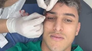 أحمد عيد لاعب المصرى يتعرض لجرح قطعى فى الحاجب قبل مواجهة سيمبا بالكونفدرالية