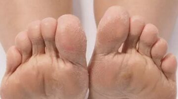 إصابة رجل بعدوى رئوية بسبب عادة شم الشرابات.. أستاذ صدر يعلق