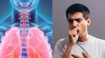 رياح الخماسين.. نصائح لمريض حساسية الصدر.. يجب اتباعها
