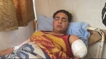 عاوز حقى.. عامل السيرك يروى تفاصيل هجوم النمر وبتر ذراعه