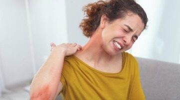 كيف يؤثر التوتر على جلدك ويسبب الأكزيما؟ خطوات فعالة للوقاية والعلاج