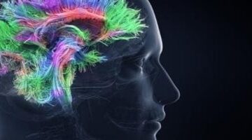 اضطراب عصبي وظيفي: ما هو وأسباب صعوبة تشخيصه؟